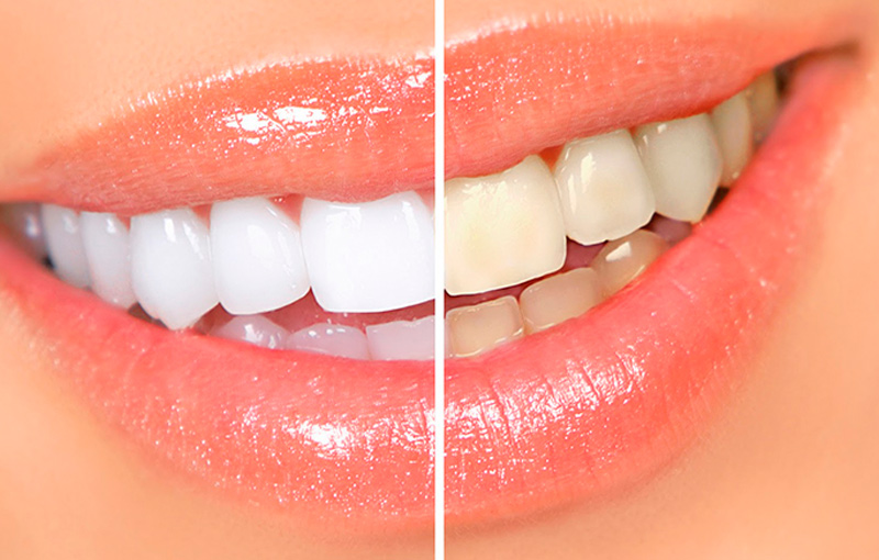 tratamientos-estetica-dental-01