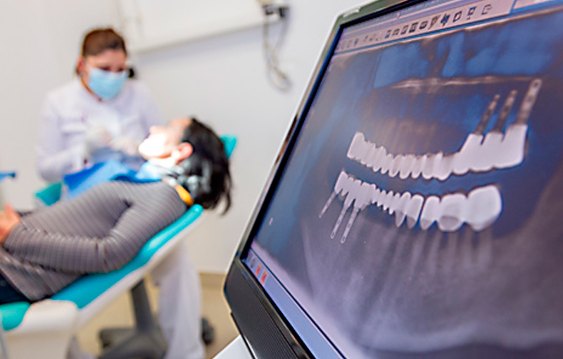 tratamientos-implantes-00